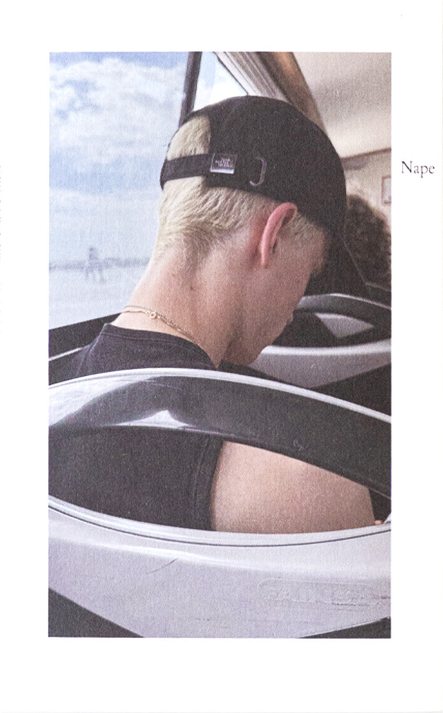 Nape